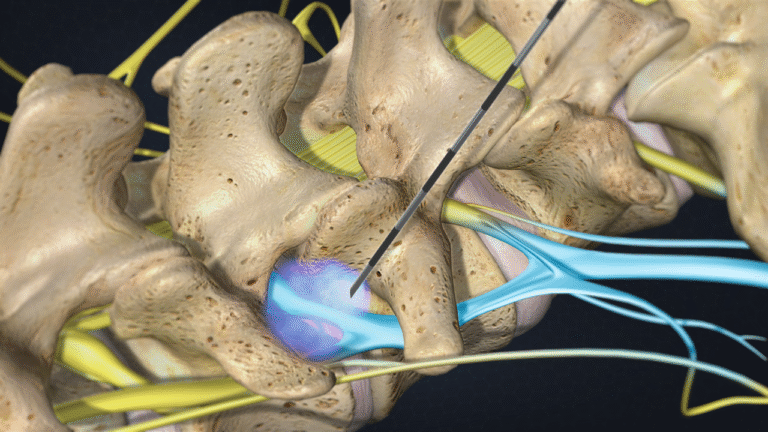 Transepisteroid Image 0016